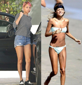 Christine Richie b4 and after anorexia